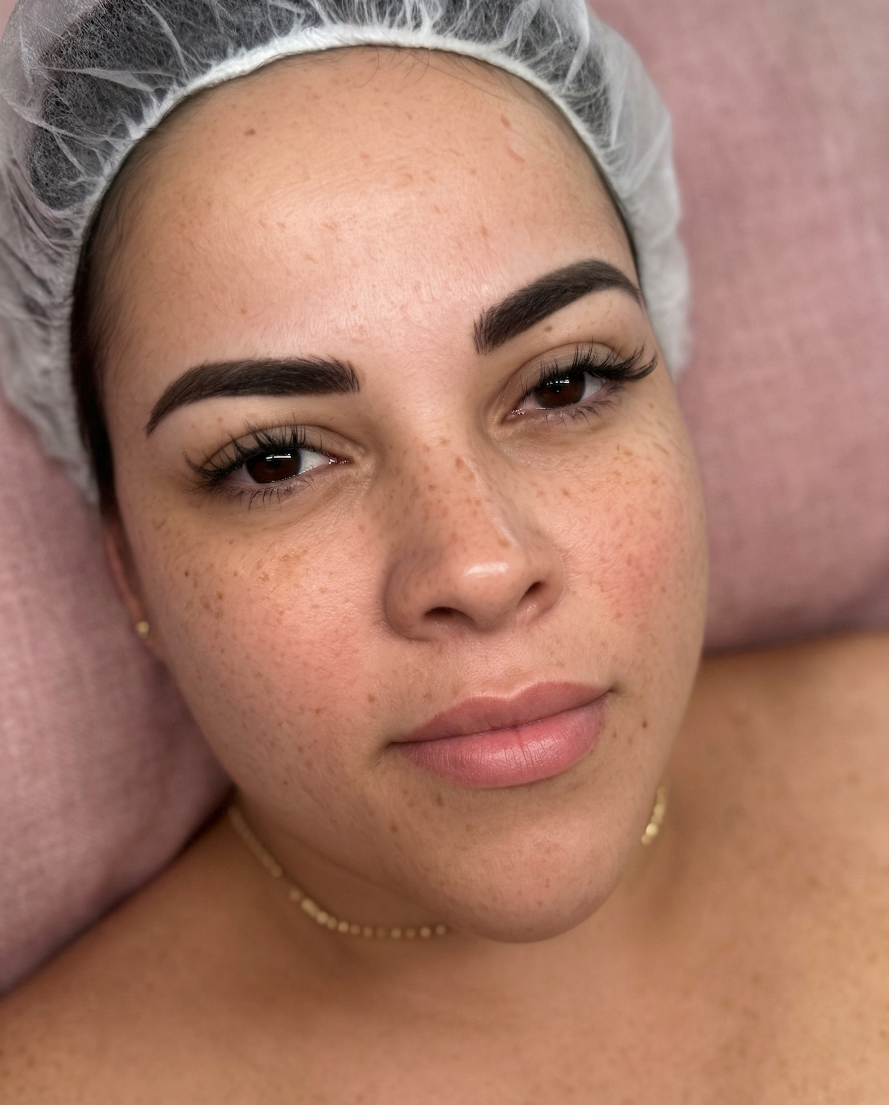 Microshading result — natural freckled skin