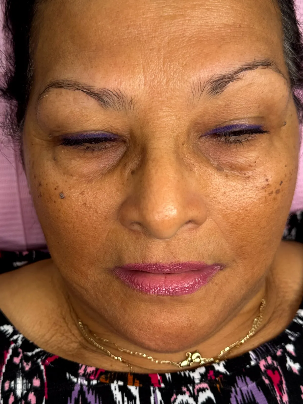 A client’s brows before treatment — sparse natural hair, thin through the arch and tail
